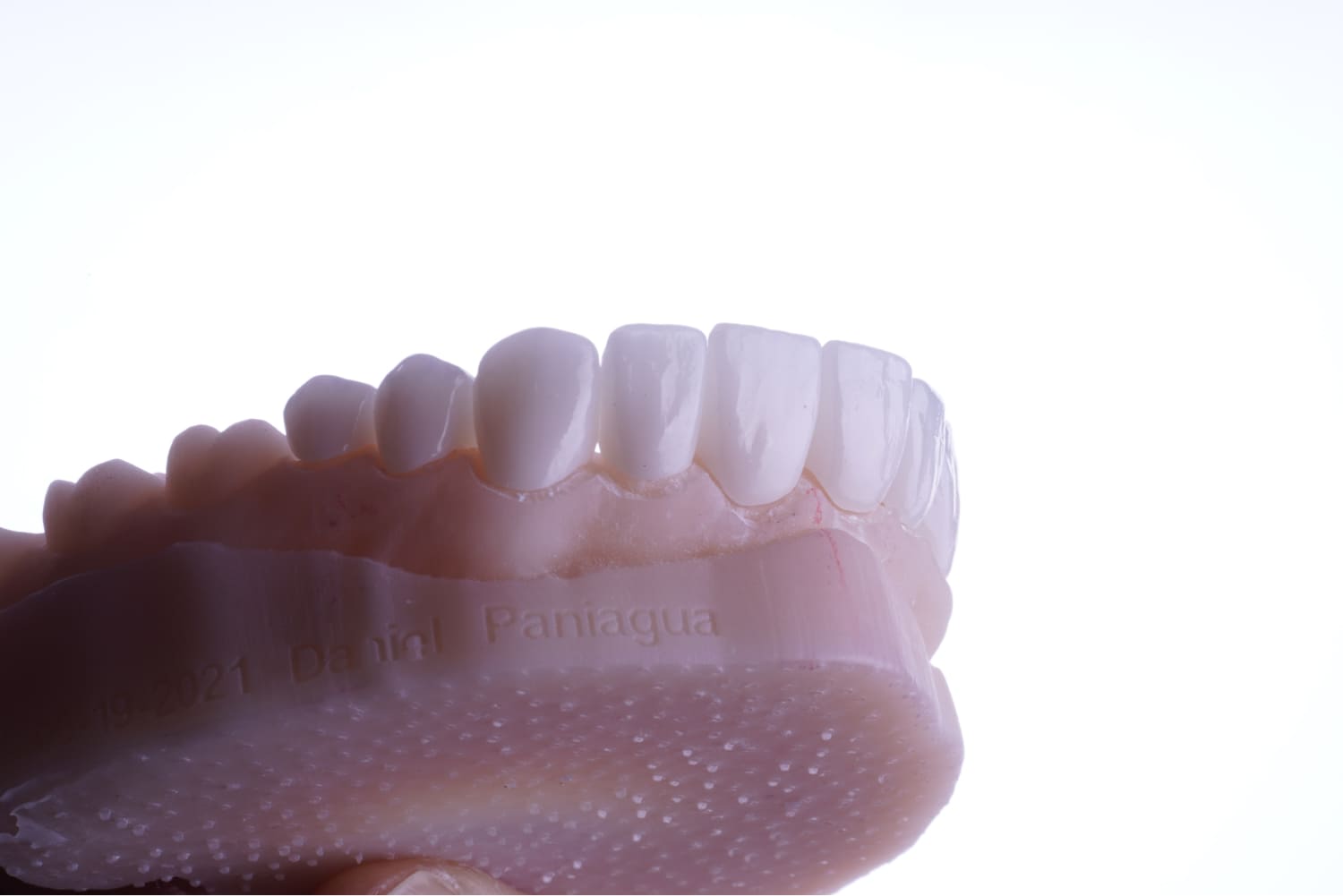 Types of Dentures in Dallas, TX, Floss Dental Dallas