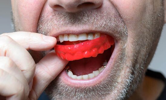 Mouth Guard in Dallas, TX, Floss Dental Dallas