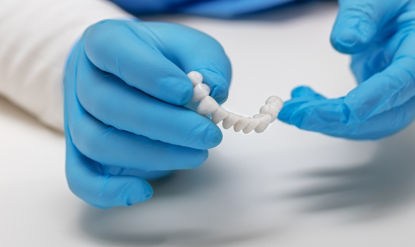 Dental Bridge Falls Out in Dallas, TX, Dentist Dallas | Floss Dental