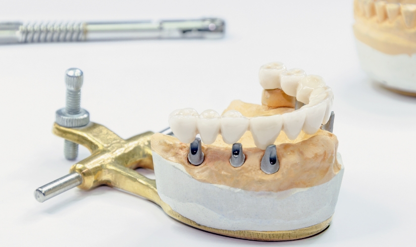 Dental Dentures in Dallas, TX, Dentist Dallas | Floss Dental
