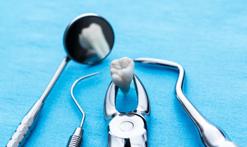 Tooth Extraction in Dallas, TX, Dentist Dallas | Floss Dental